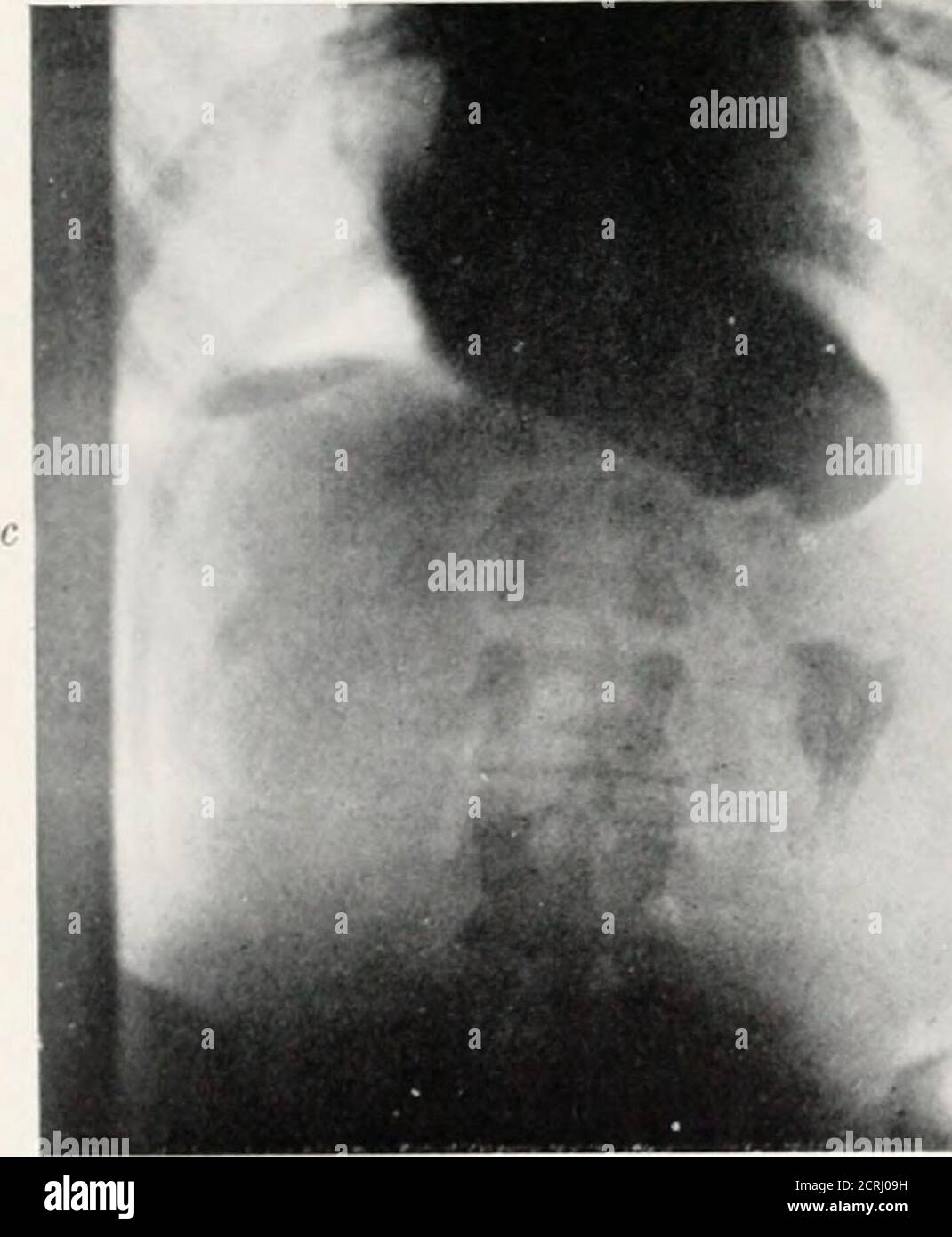 . Radiographie, traitements par rayons X et radiothérapie . i Banque D'Images