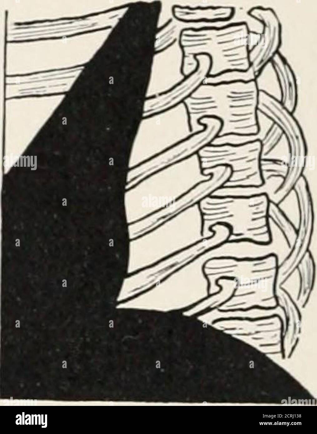 . Radiographie, traitements par rayons X et radiothérapie . FLG. 156 ...