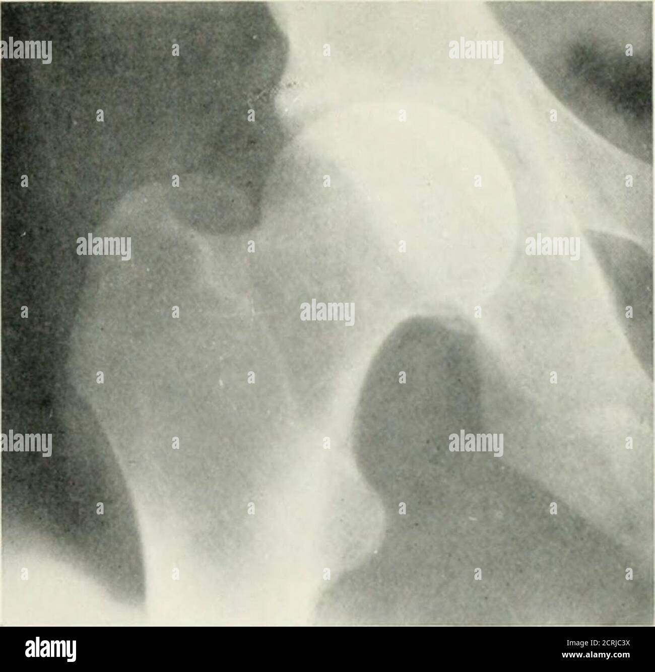 . Radiographie, traitements par rayons X et radiothérapie . Banque D'Images
