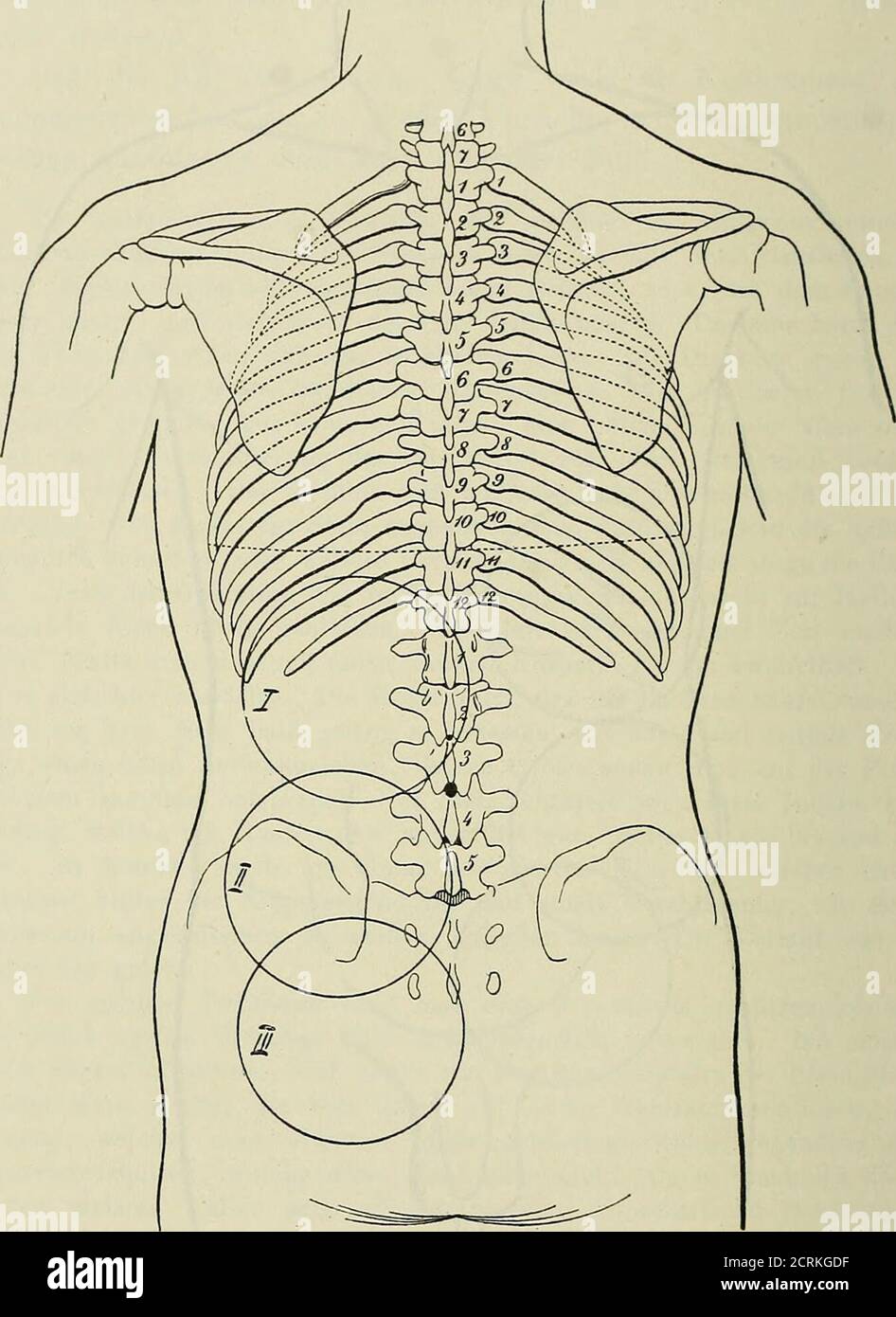 . Die Röntgentechnik : Lehrbuch für Ärzte und studierende . Mg. 111. dem Kompressionszylinder, wie unter IA beschrieben, in die Höhegehoben werden kann. Patient befindet sich in Rückenlage. Damit die Nierengegendder Platte unmittelbar anliegt, wird zum Ausgleich der mehr oderweniger entwickelten Lordose, wie in Fig. 113 u. 114 angegeben, eindreieckiger Bock unter die Kniegelenke geschoben. Die untere Albers-Schönberg, Röntgentechnik. 2. Aufl. 19 290 16. Chapitre. Apertur des Zylinders (13 cm), largeur sur la fig. 111 der obersteKreis zeigt, so auf die Rippen aufgesetzt, daß die Lichtachsedroch den Banque D'Images