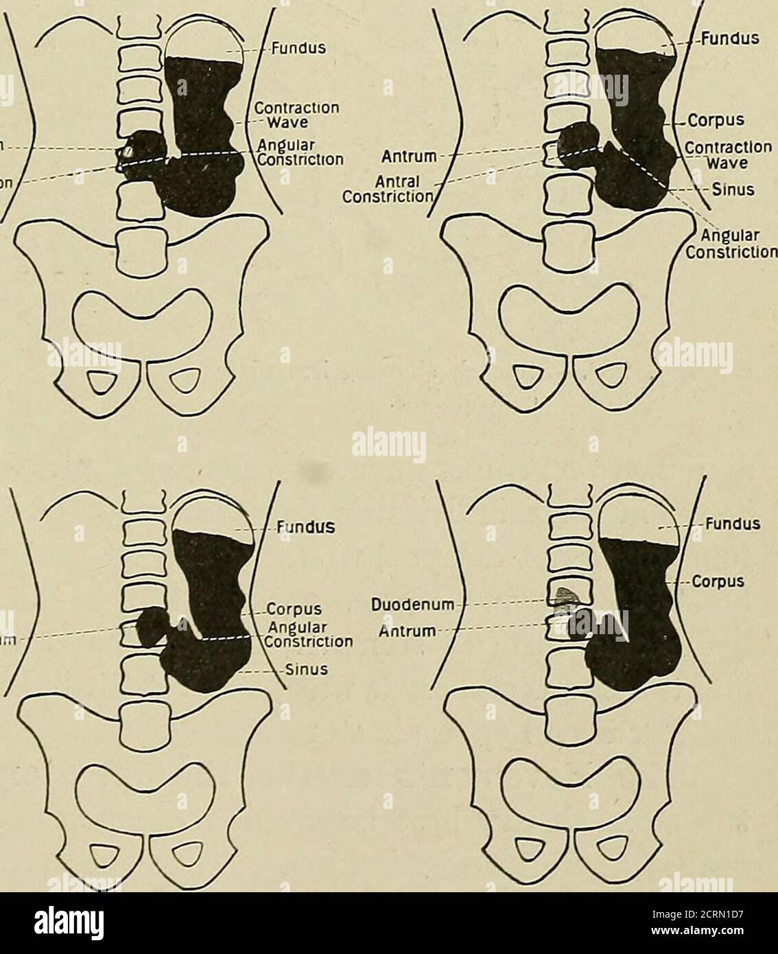 Radiographie et radiothérapeutique . et la taille de l'estomac normal ont  été décrits ; mais l'interprétation radiographique 22 338 de l'EADIOGRAPHIE  serait facilitée si la division en groupes selon le tonus