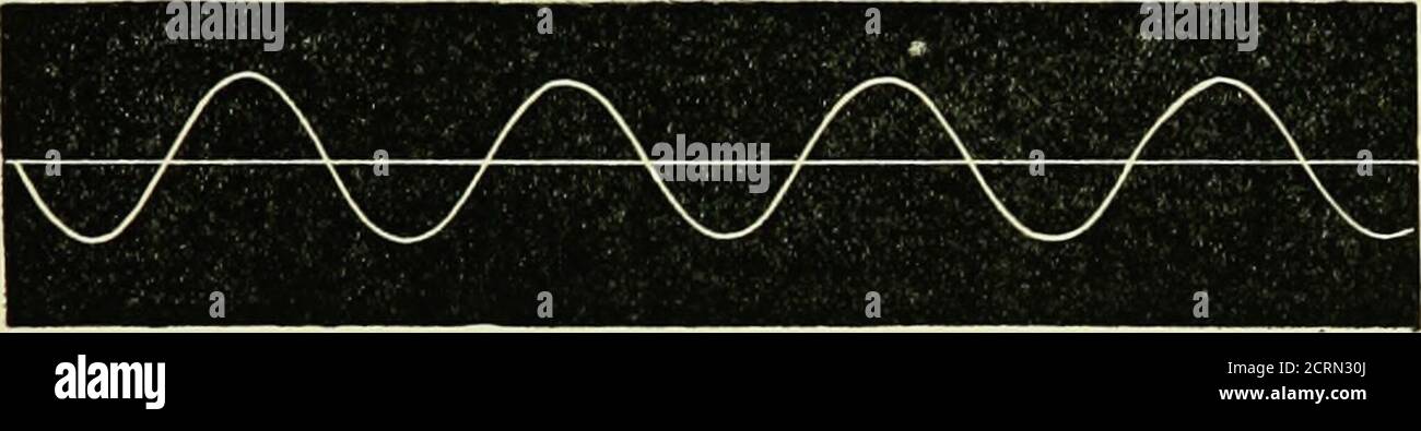 . Electro-thérapeutique et rayons X . ms, et convalescence de diverses maladies, il a proveda plus précieux complément aux soins médicaux. COURANT D'ALARME SINUSOÏDAL OU RAPIDE. En quelques années, beaucoup d'intérêt a été développé dans la forme d'un courant électrique, décrit de manière anewale, appelé sinu-soidal par DArsonval, en raison de la sinusoidalforme régulière de la courbe produite par le courant quand graphitallyreprésenté. Par le courant sinusoïdal est un courant alternatif induéd, dans lequel non seulement la montée et la chute de la force potentielle orélectro-motrice de la direction positive est immédiate Banque D'Images