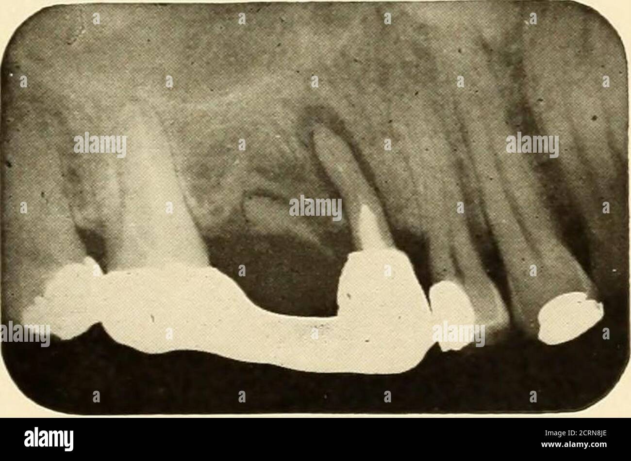 . Roentgoenologie orale : étude de Roentgen sur l'anatomie et la pathologie de la cavité buccale . Figure 289. Figure 290. Banque D'Images