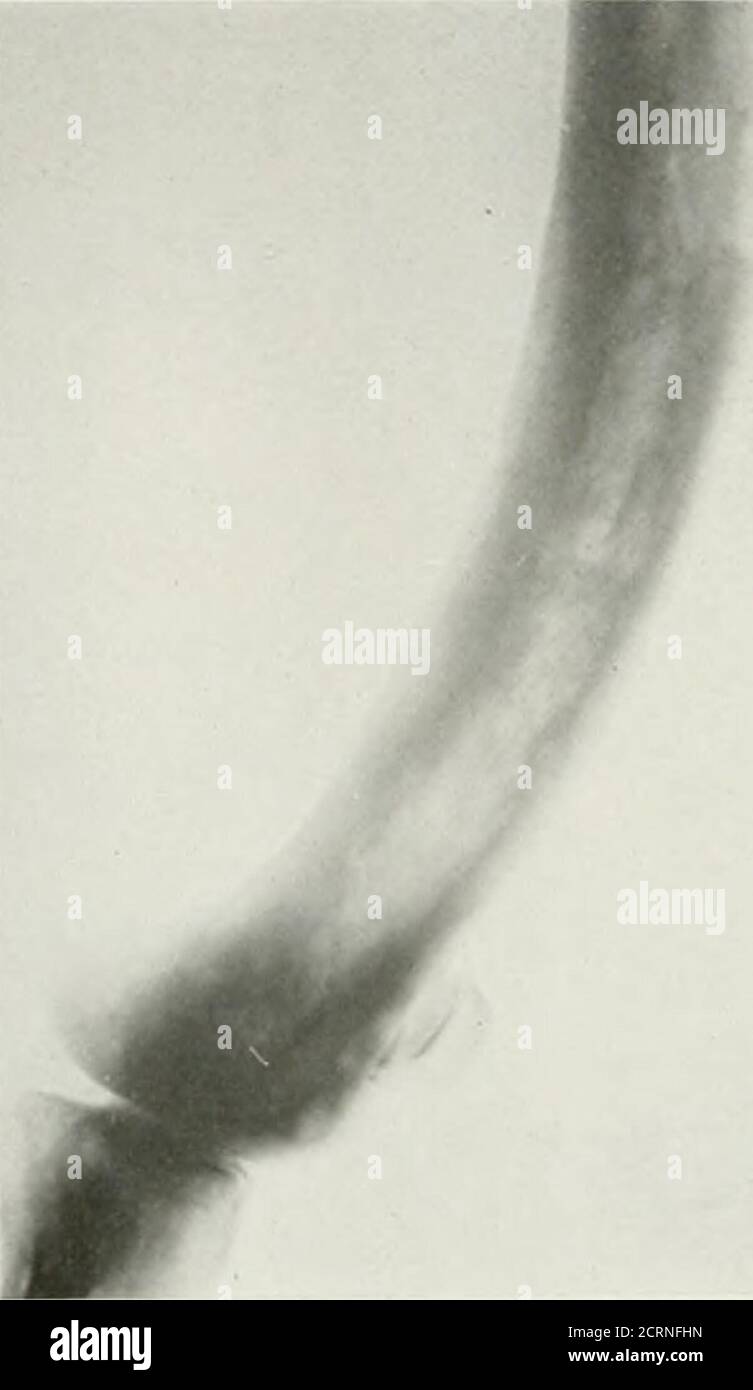 . La revue américaine de roentgoenologie, de radium thérapie et de médecine nucléaire . Banque D'Images