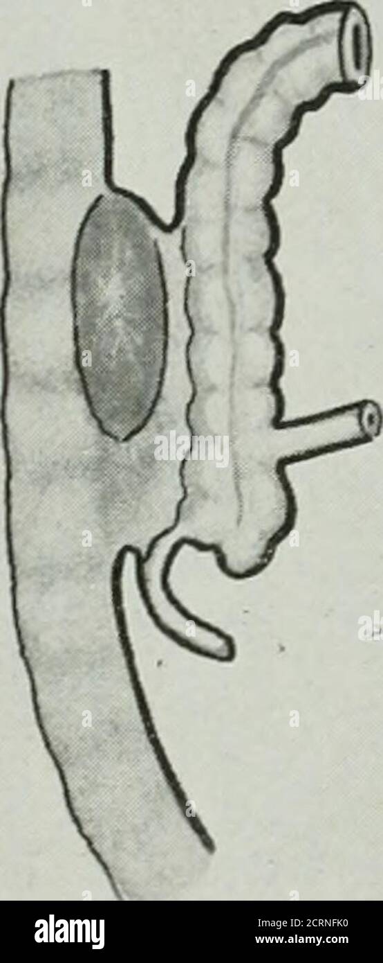 . La revue américaine de roentgoenologie, de radium thérapie et de médecine nucléaire . Banque D'Images
