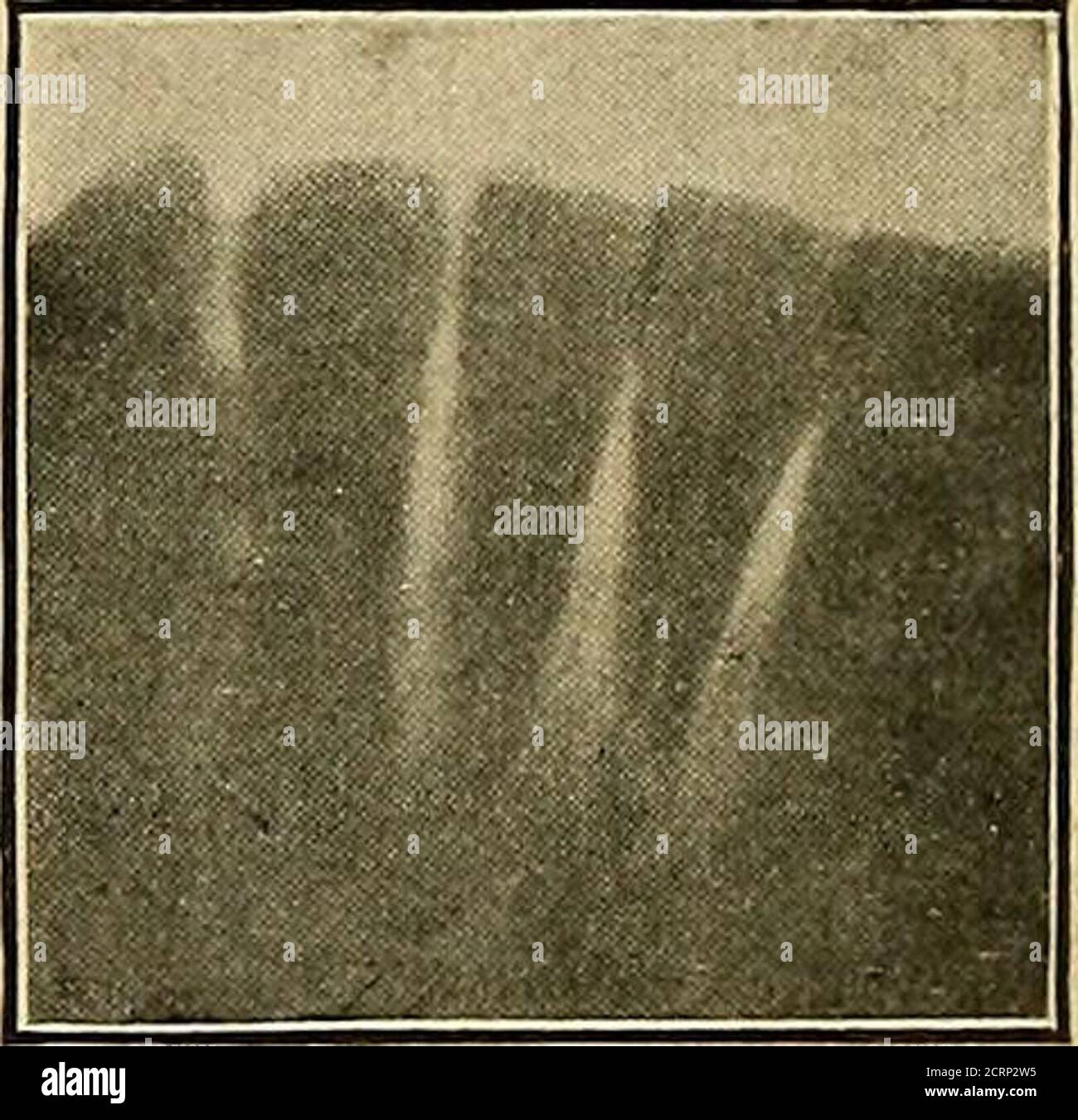 . Les rayons de Roentgen en médecine et en chirurgie comme aide au diagnostic et comme agent thérapeutique : conçu pour l'usage des praticiens et des étudiants . Fig. 382, 383. Patient du Dr Clapp. Instrument cassé dans la mâchoire. L'instrument a été forcé à travers le centre, et est resté dans la mâchoire un an, causant un abcès sérieux. Ces deux coupes montrent la grande haibilité à l'erreur dans le diagnostic à partir des images radiographiques à moins que deux vues ne soient prises. Une des coupes représente l'instrument comme dépassant de l'apex du centre; l'autre, thatit se trouve entre.le centre et latéral. Ce dernier était la véritable positio Banque D'Images