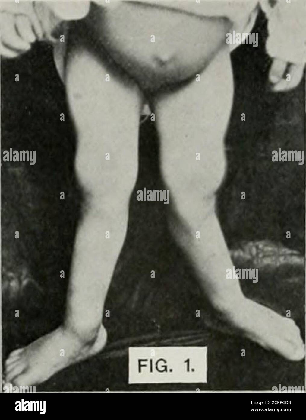 . Anatomie et pathologie vivantes ; le diagnostic des maladies au début de la vie par la méthode de Roentgen . Banque D'Images