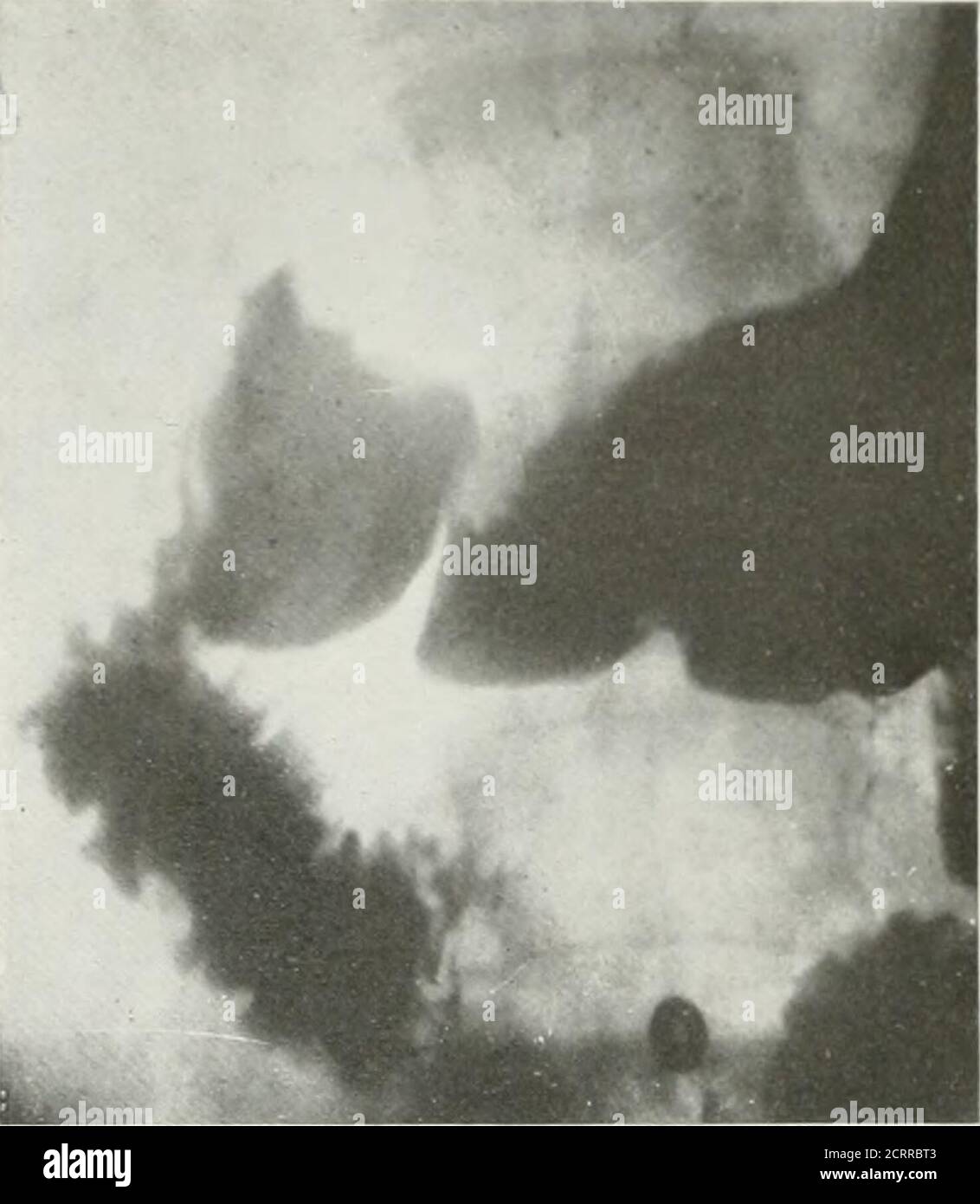 . La revue américaine de roentgoenologie, de radium thérapie et de médecine nucléaire . Banque D'Images