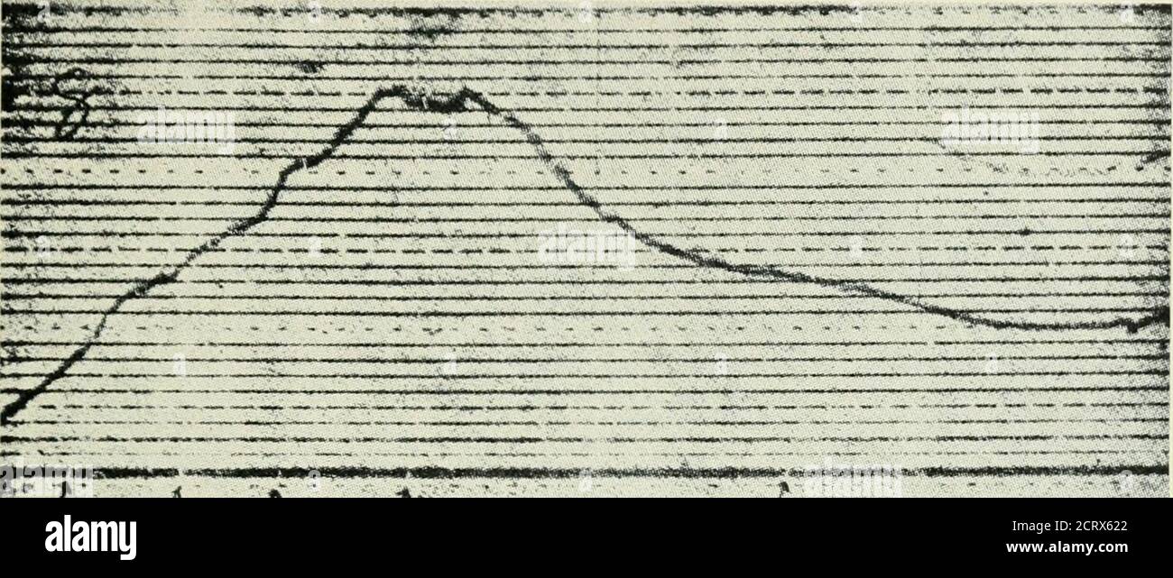 . Le journal technique du système Bell . scillator au moyen d'un cristal — dans ce cas, le sel de Rochelle — et a le brevet d'oscillateur à quartz primaire.-circuit de Nicolsons est illustré à la Fig. 1.3. Le cristal est effectivement dans un chemin entre la bobine de résonance dans la sortie et la grille, puisque l'électrode ^ l'effet piézoélectrique dans le sel composite Rochelle Crjstal-Froc.A.LE.E. 1919,38, 1315. 2 Voir brevet 2,212,845 déposé le 10 avril 1918; délivré le 27 août 1940. -R. M. Nicolson, QUARTZ APPLICATIONS 181 3 est dans la direction du plus petit effet piézoélectrique de Rochelle saltand contribue à l'éclairage Banque D'Images