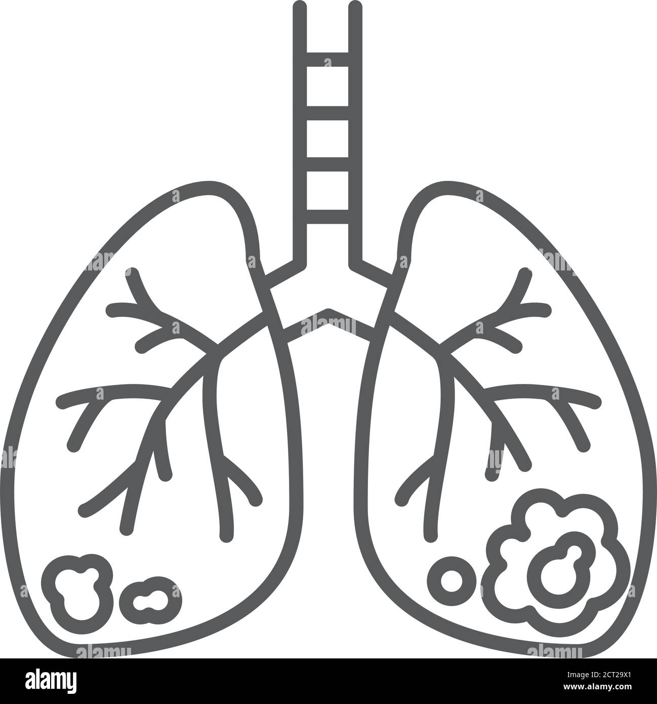 Icône noire de la ligne de cancer des poumons. Concept d'organe humain. Néoplasme malin. Inscrivez-vous pour accéder à la page Web, à l'application mobile, au bouton et au logo. Illustration de Vecteur