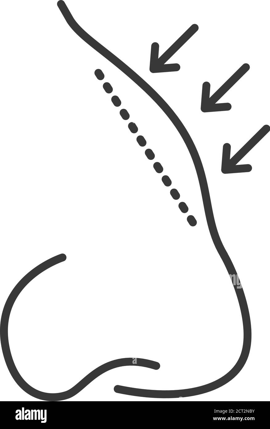 Icône de la ligne noire de rhinoplastie. Chirurgie plastique de changement de forme de nez. Cosmétologie, soins de la peau. Inscrivez-vous pour accéder à une page Web, une application mobile, une bannière, des réseaux sociaux. Modifiable Illustration de Vecteur