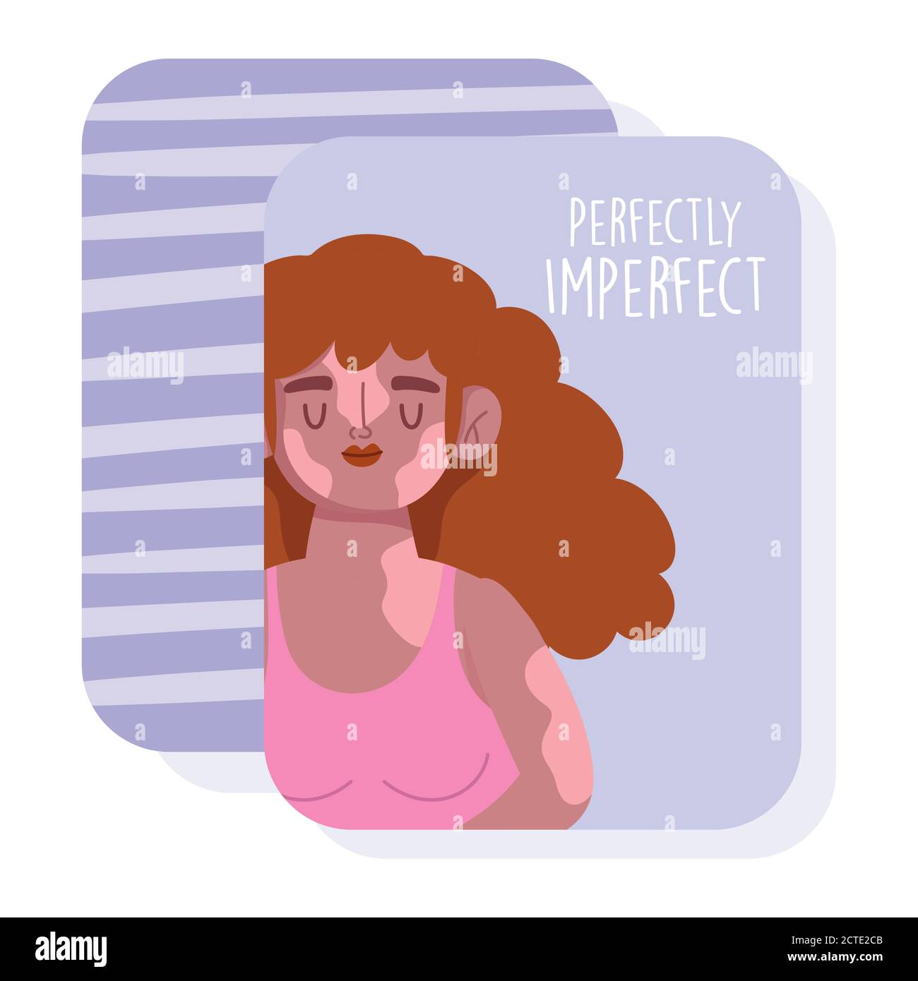 parfaitement imparfaite, caricature femme cheveux bouclés et illustration du vecteur de la maladie de vitiligo Illustration de Vecteur
