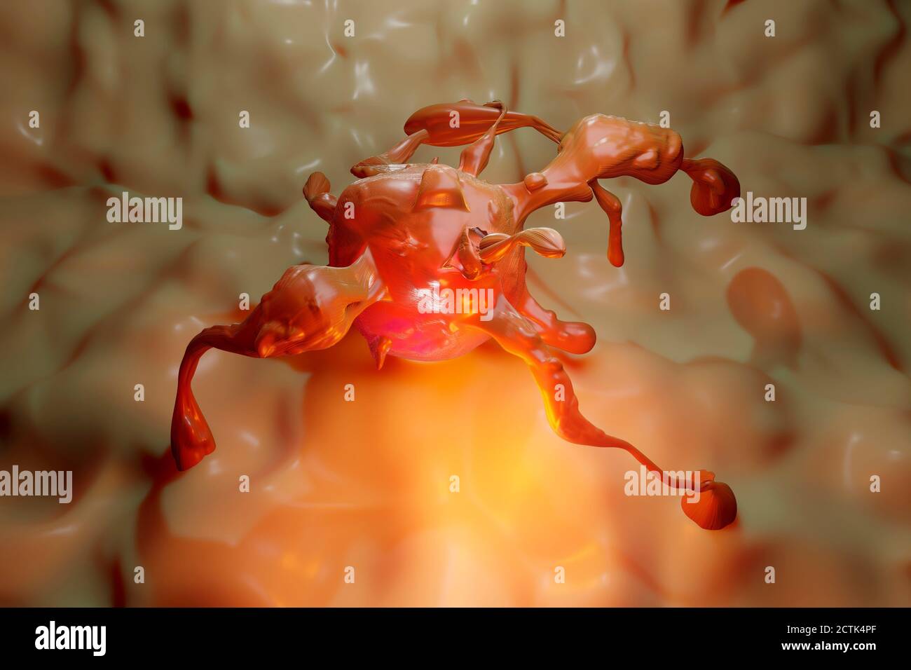 Tumeur cancéreuse Banque de photographies et d’images à haute résolution Alamy