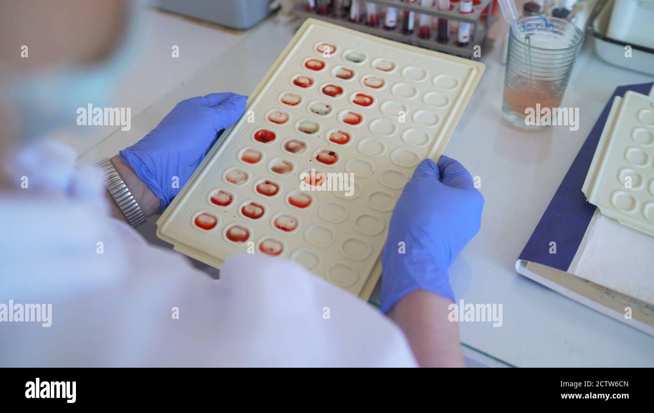 le médecin détermine la qualité du sang. Le médecin détermine l'alcool par le sang. Le sang a été prélevé pour analyse. Un médecin examine le sang Banque D'Images