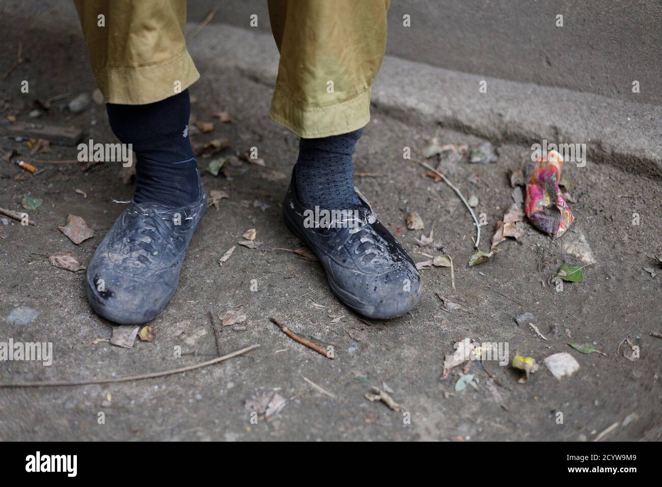 The feet of porter Ibrahim Sino, 33, are pictured following a 16-day K2  base camp trek, in the village of Askole in the Karakoram mountain range in  Pakistan September 11, 2014. A