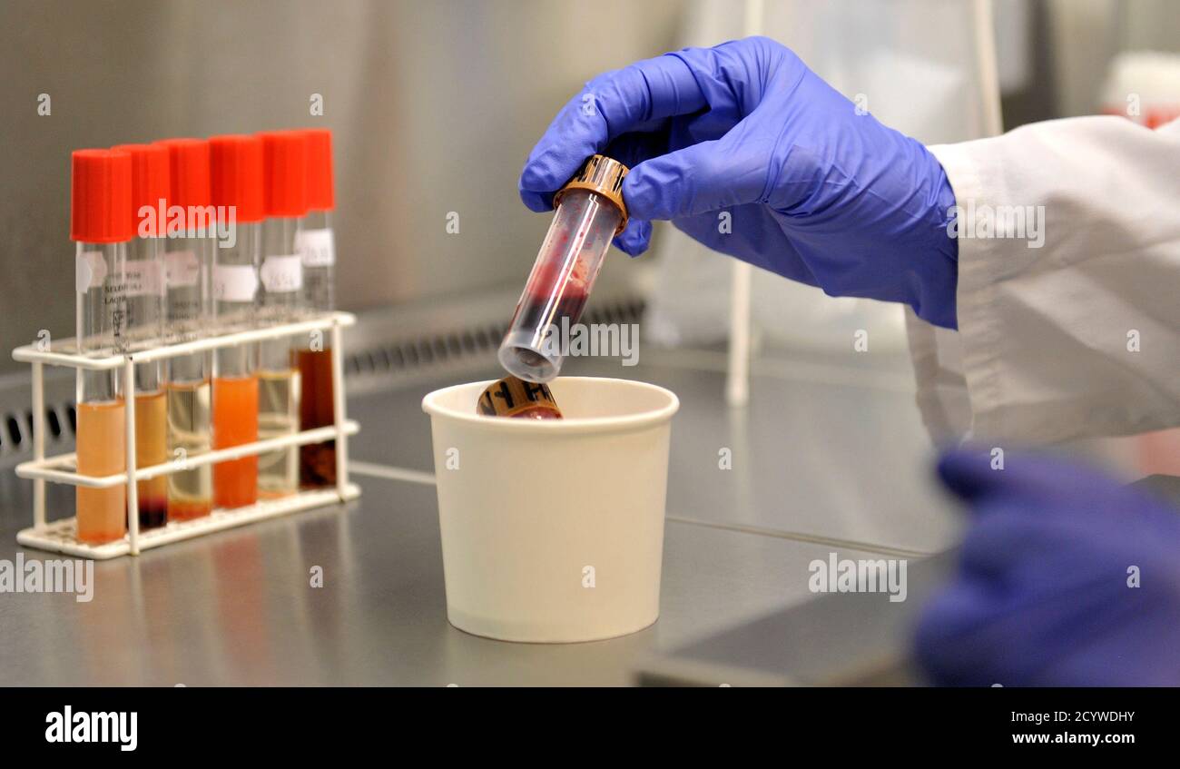 Escherichia Bactérie Coli Banque d'image et photos - Alamy