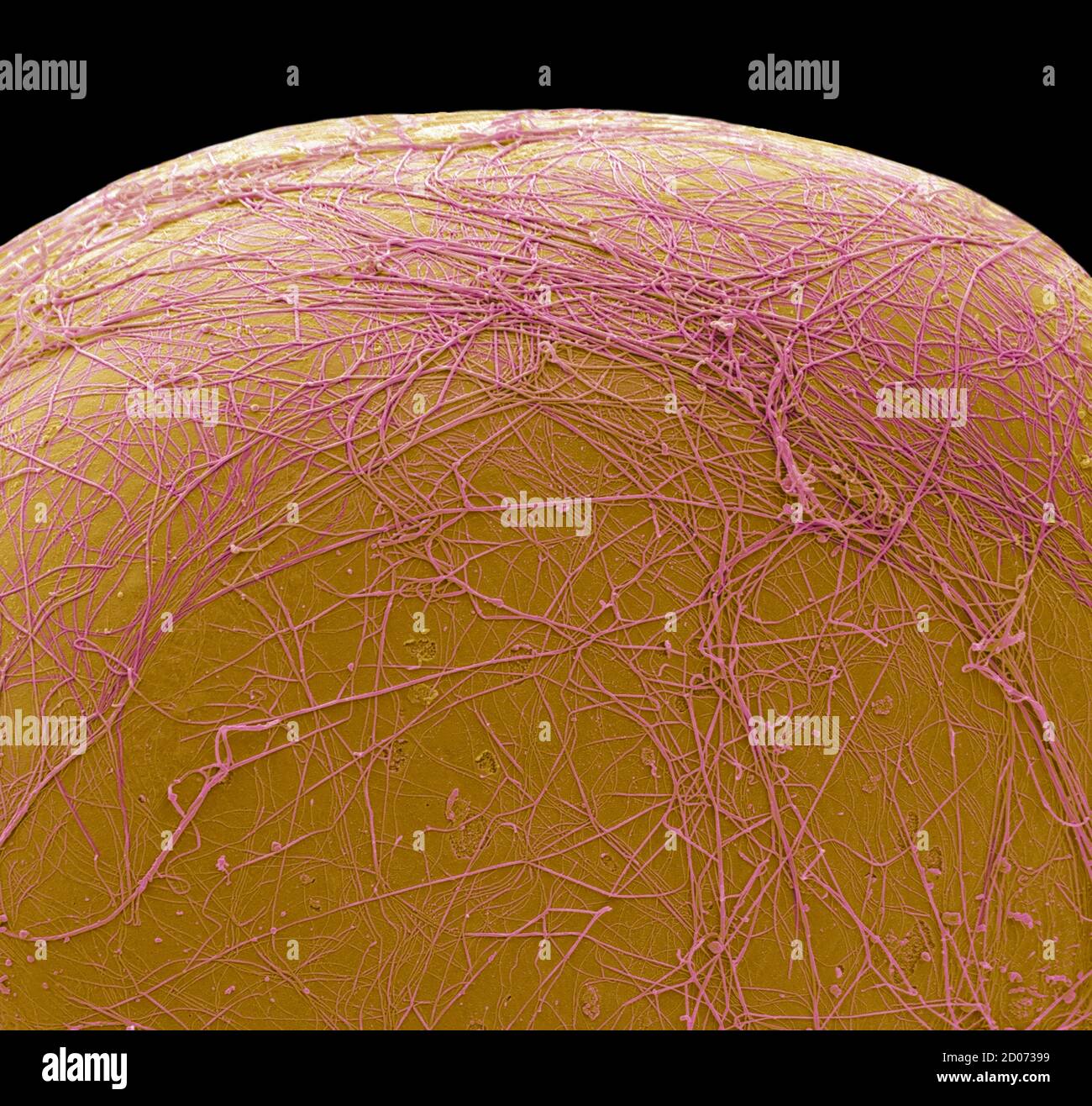 Cellule graisseuse. Micrographe électronique à balayage coloré (SEM) d'une partie d'une cellule stockant la graisse (adipocytes). Les cellules graisseuses sont l'un des plus grands types de cellules de la h Banque D'Images