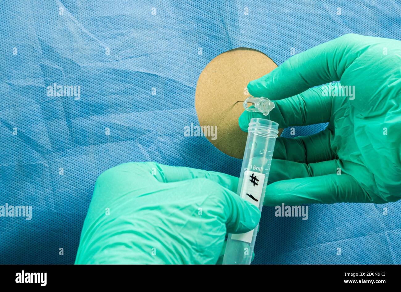 Personne atteinte de myélite transverse après avoir été injectée par le vaccin expérimental Oxford Covid-19, le médecin extrait le liquide céphalo-rachidien pour envahir Banque D'Images