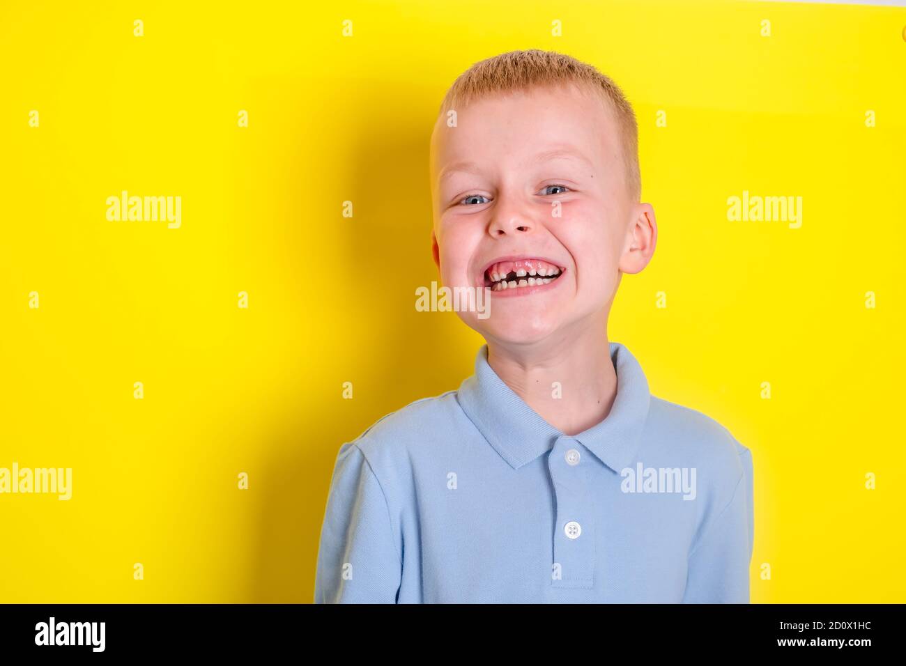 Le Garcon Sourit Sans La Dent Superieure Du Bebe Un Trou Dans Le Sourire D Un Enfant Concept Gai Soins De Sante Hygiene Dentaire Photo Stock Alamy