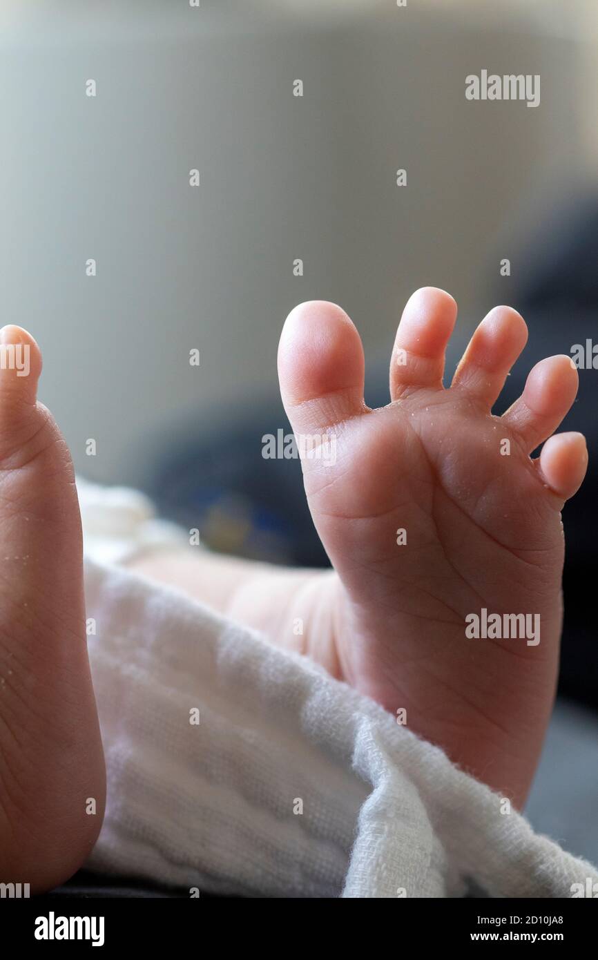 Ongle D Orteil Banque D Image Et Photos Alamy Ongle D Orteil Banque D Image Et Photos Alamy