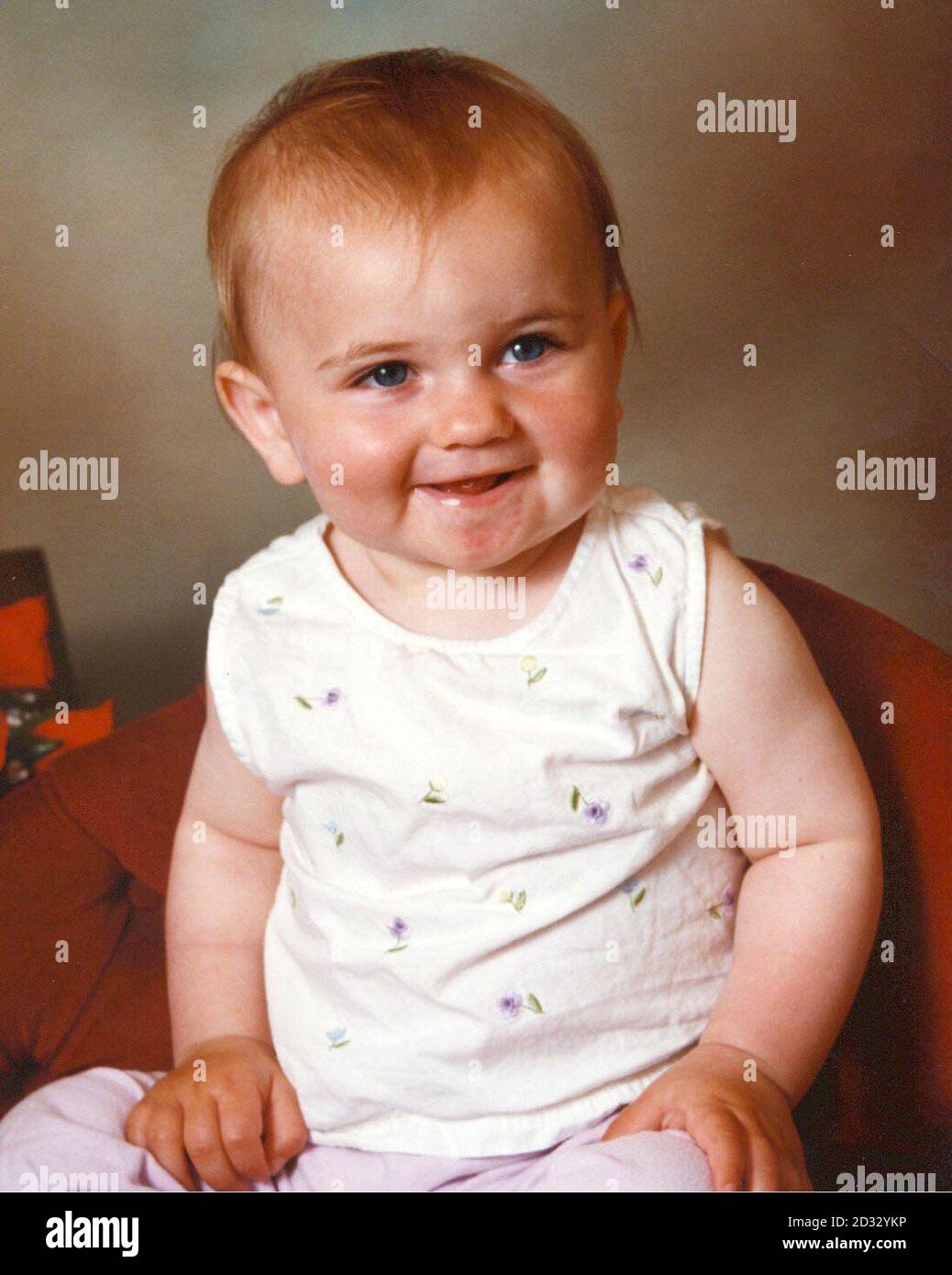 Cigarette Burn Child Banque D Image Et Photos Alamy Cigarette Burn Child Banque D Image Et Photos Alamy