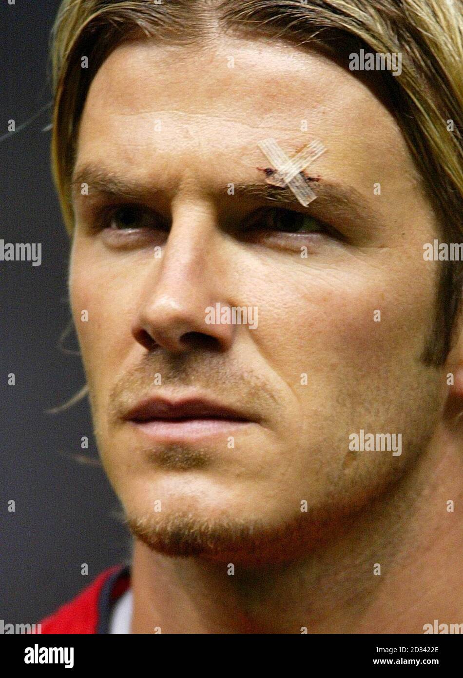 Un plâtre est visible au-dessus du sourcil gauche de David Beckham, le  milieu de terrain de Manchester United, lors de la formation de l'équipe  avant le match du groupe D de la