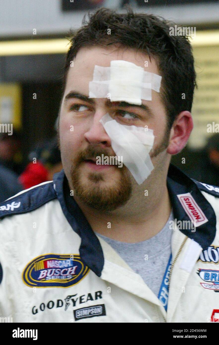 Pit crew worker Patrick Shafer, a front tire changer for the number 27  Kleenex/Winn Dixie Pontiac, walks down pit road after receiving first aid  after he went flying as the car made