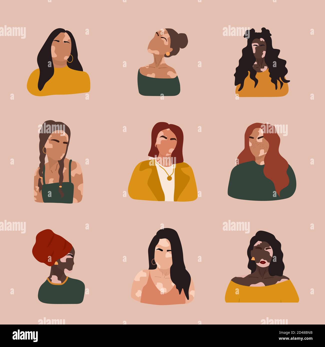 Femmes silhouettes abstraites avec vitiligo de différentes nationalités. Vecteur concept pour soutenir les personnes vivant avec le vitiligo et pour renforcer la conscience Illustration de Vecteur