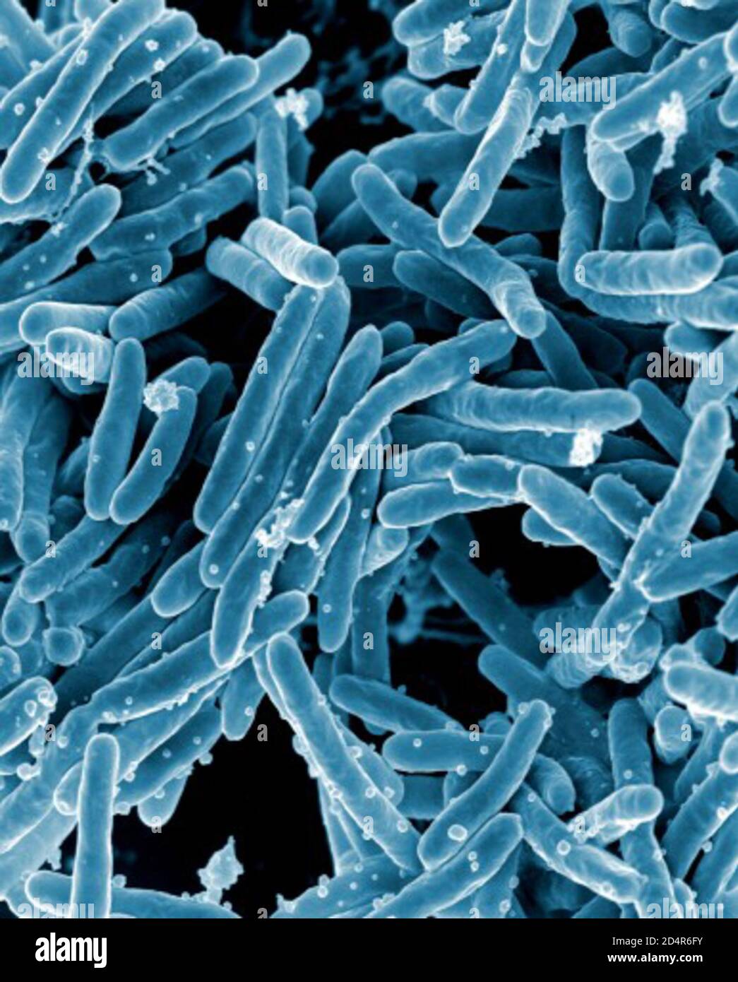 Bactéries Mycobacterium tuberculosis Micrographe électronique à balayage des bactéries Mycobacterium tuberculosis, qui causent la tuberculose. Crédit: NIAID ; Cré Banque D'Images