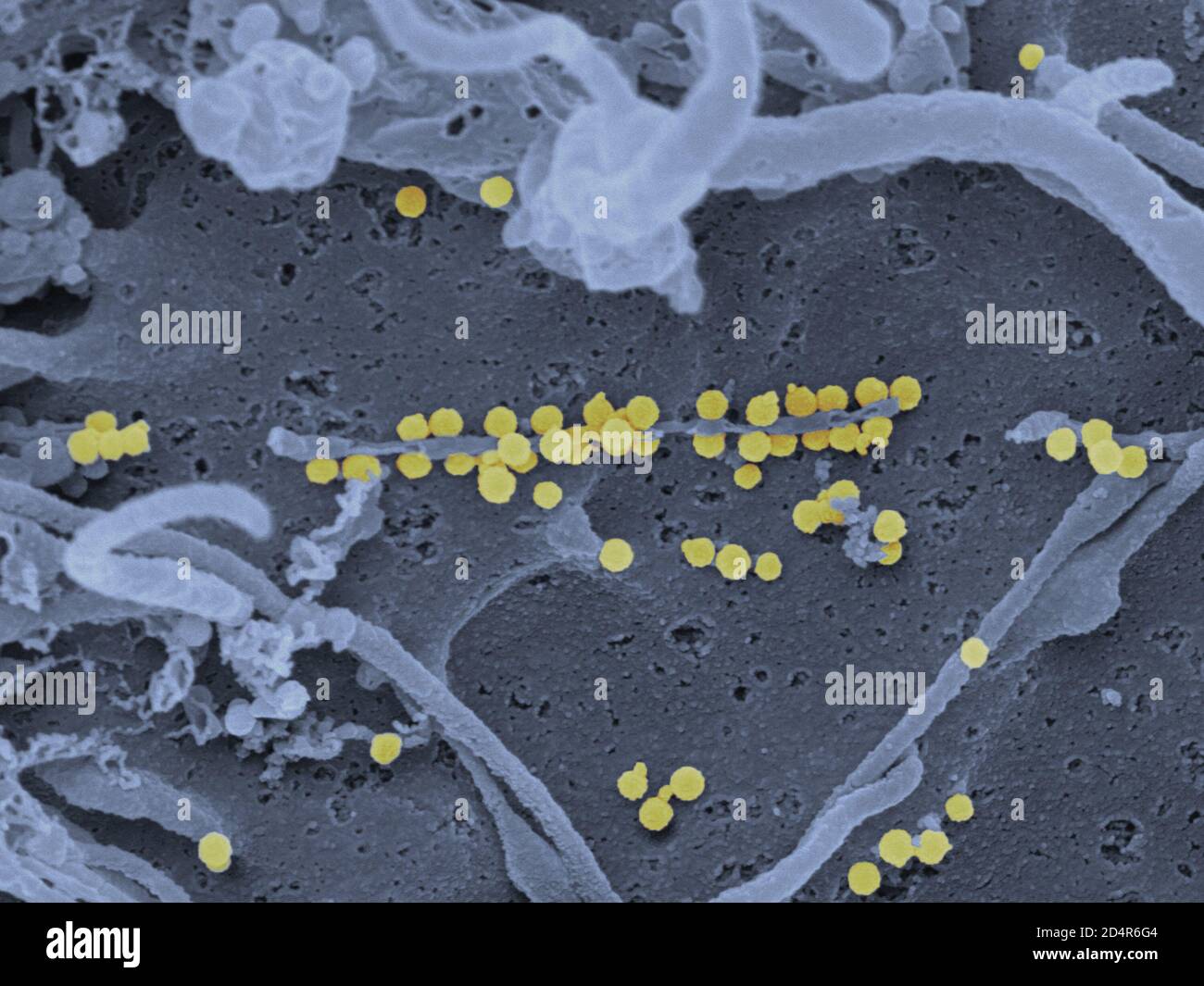 Micrographe électronique à transmission colorée (TEM) des virus de la fièvre hémorragique de Crimée-Congo (CCHF) (marron). Le CCHF est transmis aux humains lorsqu'ils ont un Banque D'Images