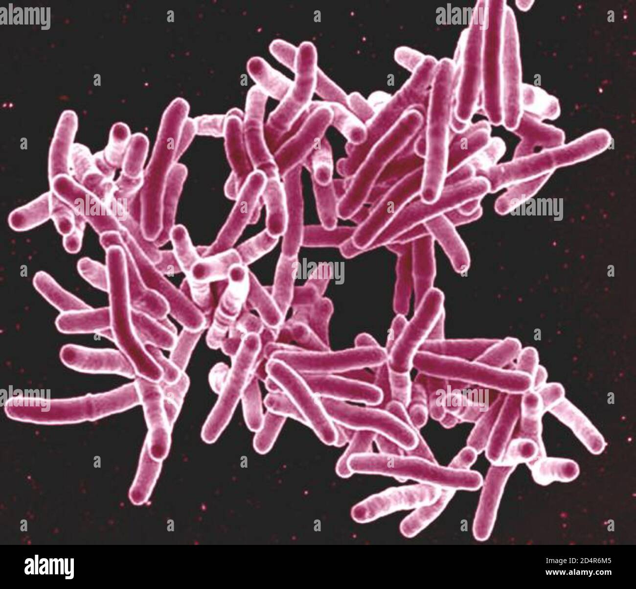 Mycobacterium tuberculosis, la cause de la tuberculose micrographe électronique à balayage des bactéries Mycobacterium tuberculosis, qui causent la tuberculose. Crédit : NIAI Banque D'Images