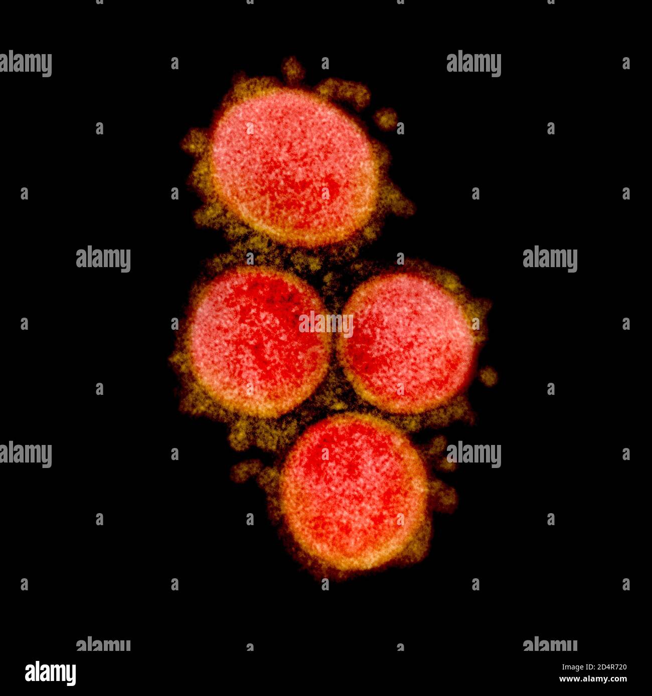 Cette image au microscope électronique à transmission montre le SRAS-COV-2, également connu sous le nom de 2019-nCoV, le virus qui cause le COVID-1, isolé d'un patient aux États-Unis Banque D'Images