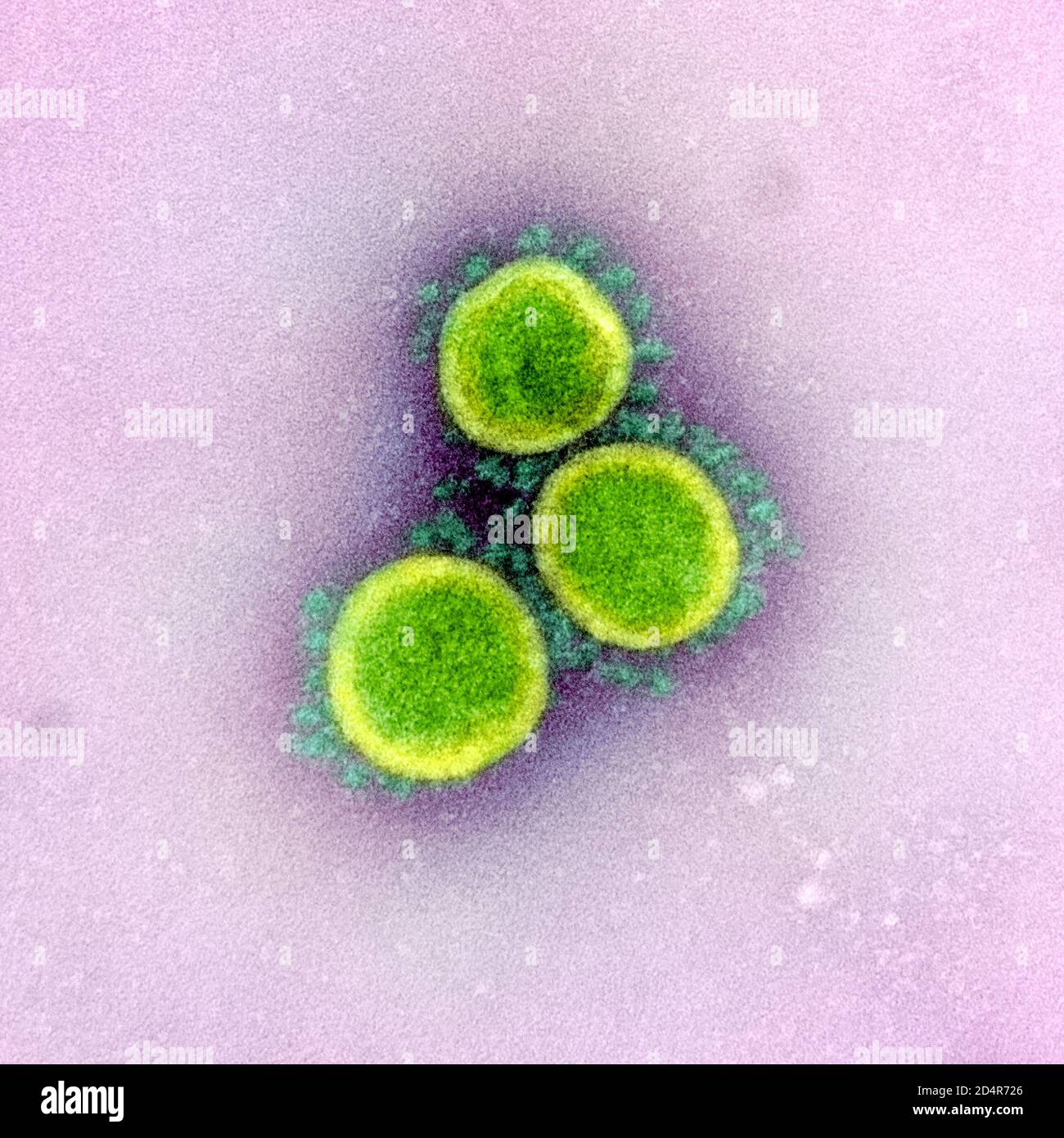 Cette image au microscope électronique à transmission montre le SRAS-COV-2, également connu sous le nom de 2019-nCoV, le virus qui cause le COVID-1, isolé d'un patient aux États-Unis Banque D'Images