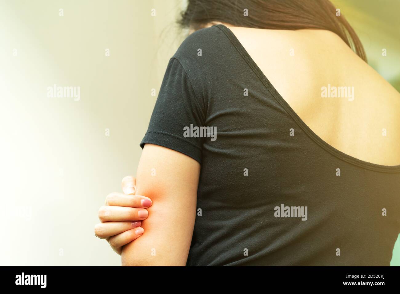 Les femmes part gratter les poils sur le bras, santé et médecine concept. Banque D'Images