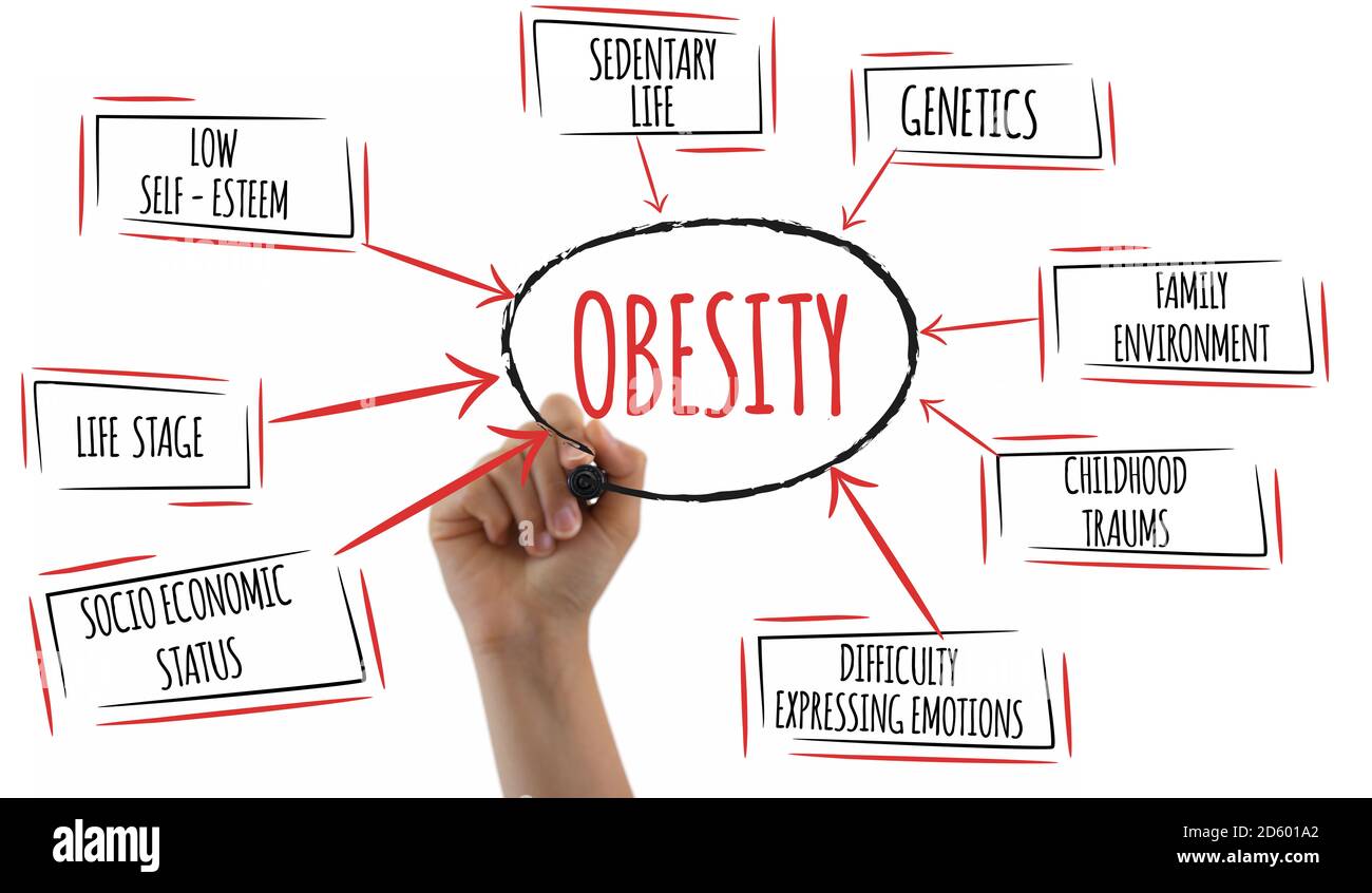 Diagramme des causes d'obésité sur fond blanc. Banque D'Images