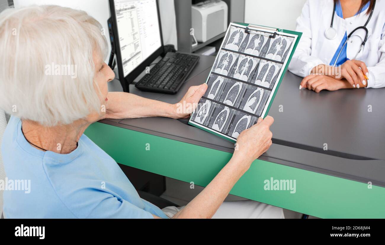 Le patient âgé détient les résultats d'une acquisition CT des poumons. Inflammation pulmonaire, bronchite et coronavirus Banque D'Images