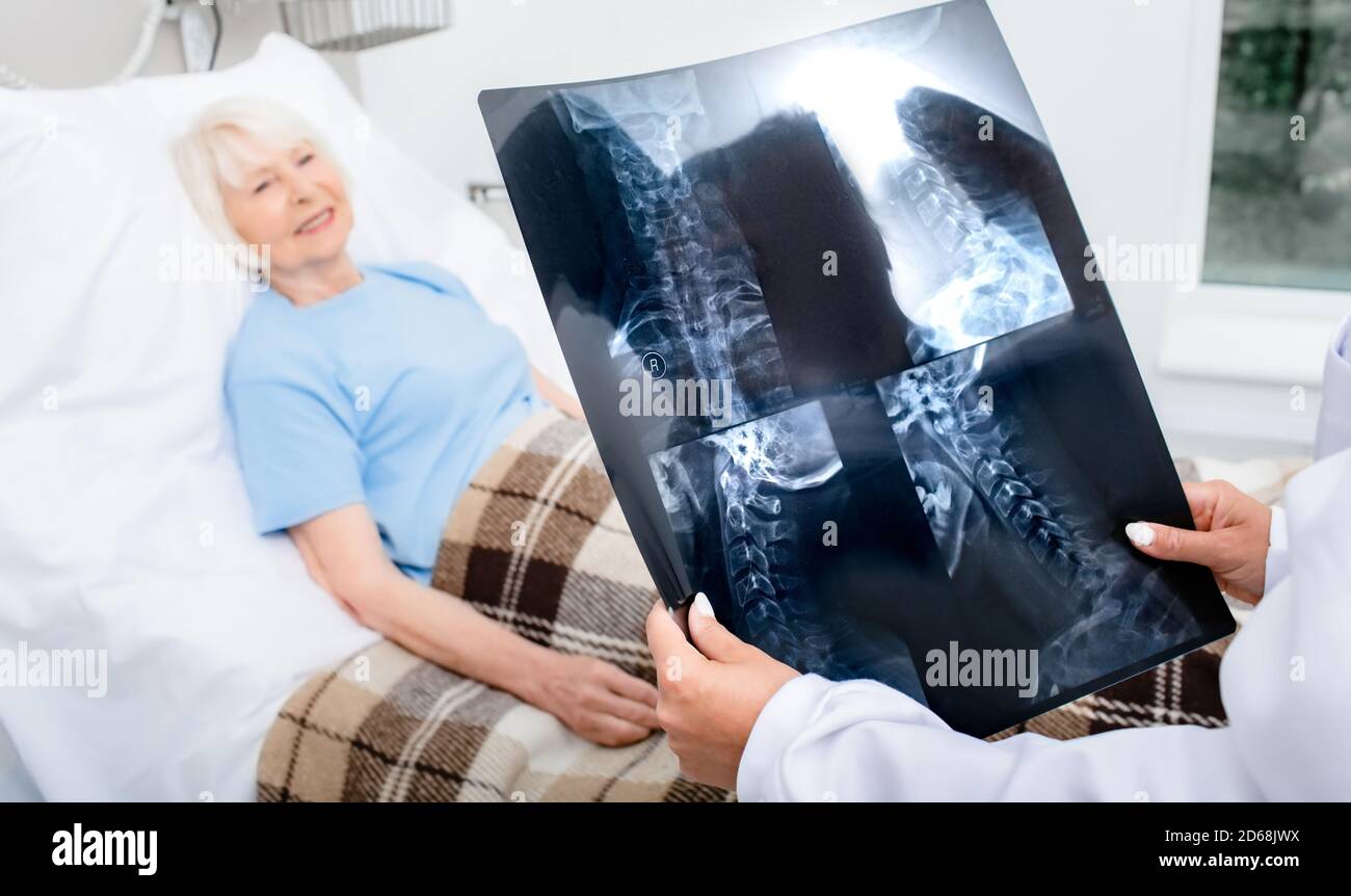 Un médecin expérimenté tient une radiographie de la colonne cervicale de la femme âgée. Traitement de la maladie de la colonne vertébrale, ostéochondrose et hernie cervicale. Fermer- Banque D'Images