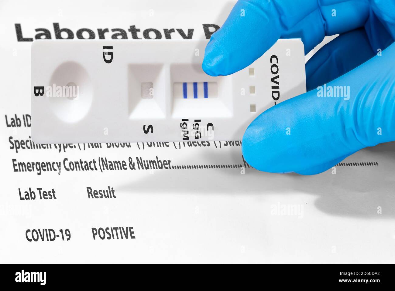 La main d'un médecin ou d'un technicien de laboratoire montre un test de laboratoire rapide COVID-19 pour détecter les anticorps IgM et IgG contre le nouveau coronavirus, le COV-SRAS-2 WIT Banque D'Images