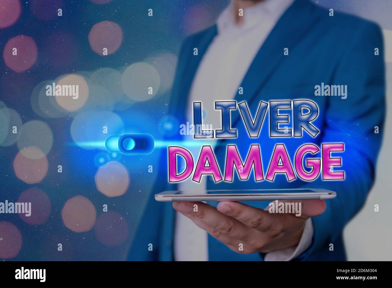 Texte d'écriture foie endommagé. Photo conceptuelle tout trouble de la cirrhose du foie ou cicatrisation du foie cadenas Graphics pour les données web Banque D'Images