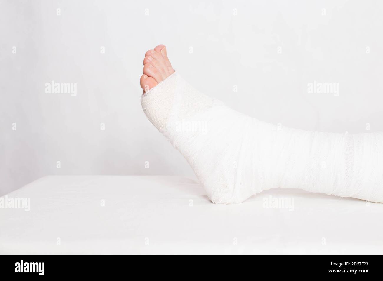 Plaie de cheville avec bandage dans un bandage de fixation serré sur fond blanc. Concept de fracture de jambe et de pansement Banque D'Images