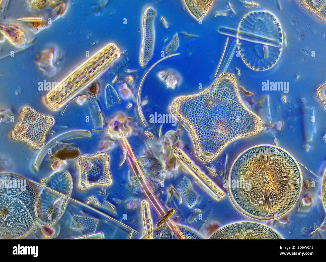 Diatomées à streptocoques, y compris Eupodiscus ralfsii Banque D'Images