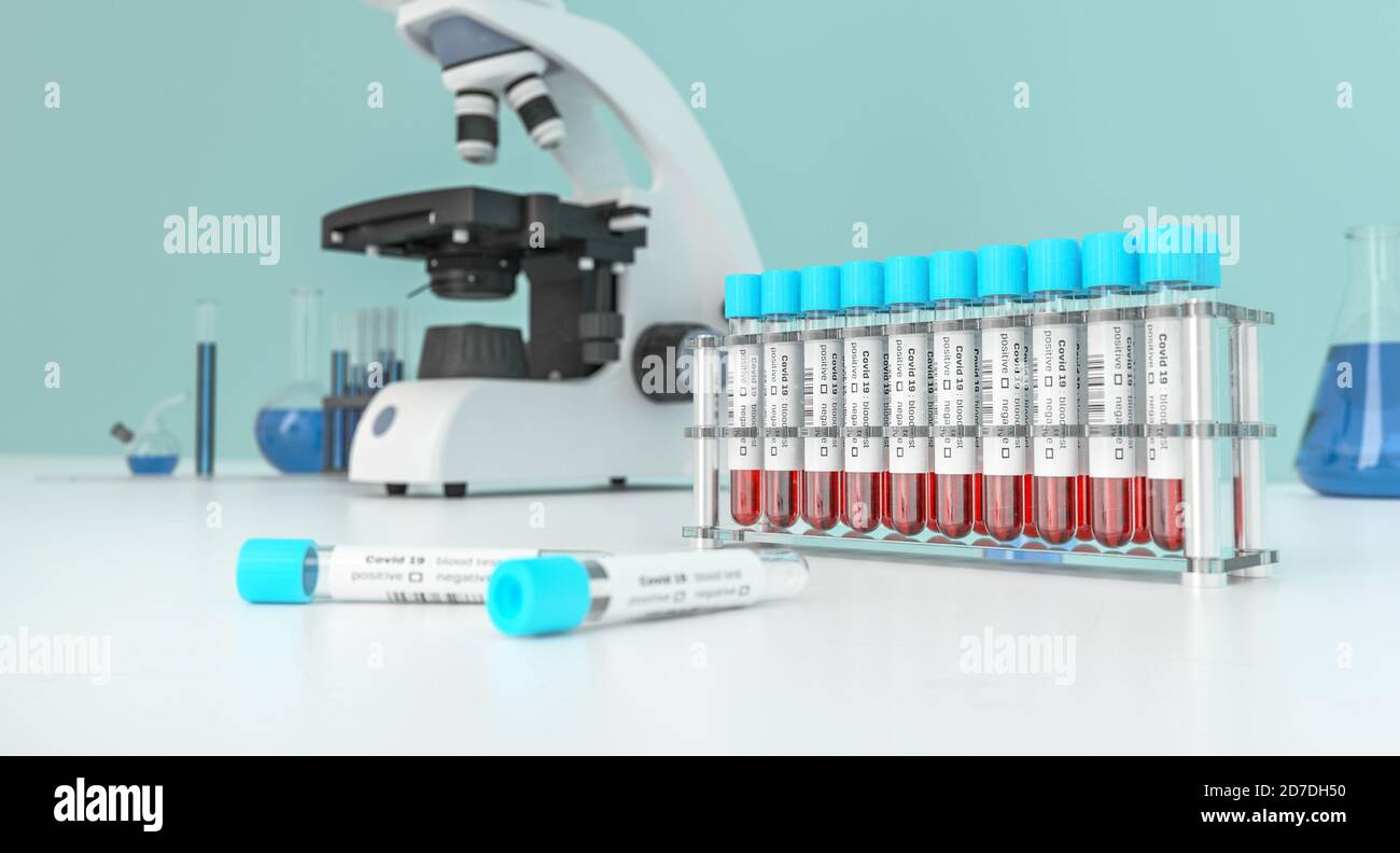 Coronavirus Covid-19 analyse de sang dans un laboratoire. Dépistage médical Covid. Échantillons de sang dans des tubes à essai en verre. rendu 3d. Banque D'Images