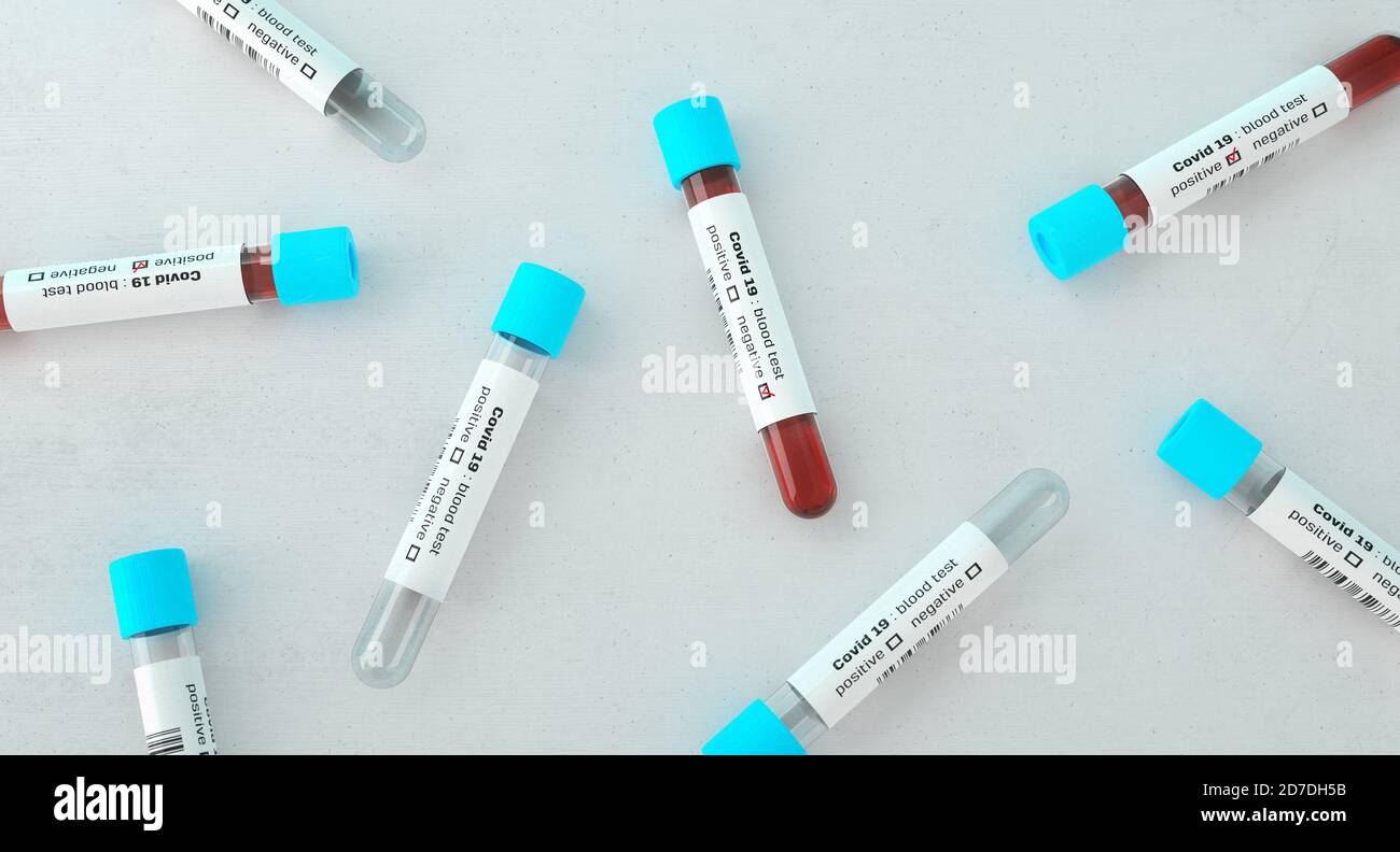 Tubes à essai remplis de sang, tests en laboratoire pour Covid-19 . Dépistage médical du coronavirus. Échantillons de sang dans des tubes à essai en verre. rendu 3d. Banque D'Images