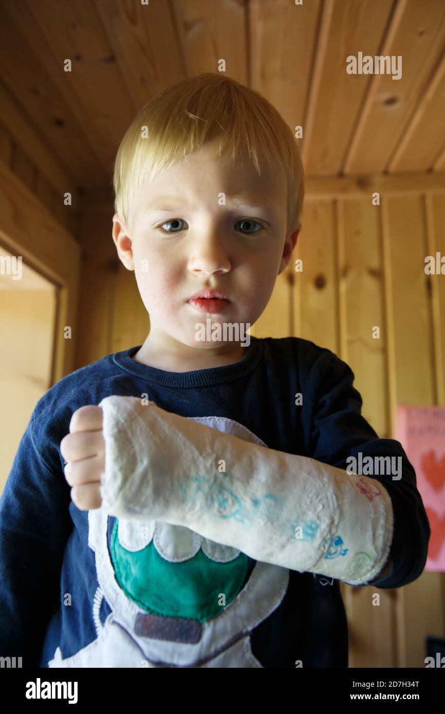 Petit garçon avec un poignet cassé à la maison. Garçon avec un plâtre sur sa main montrant son bras cassé. Banque D'Images