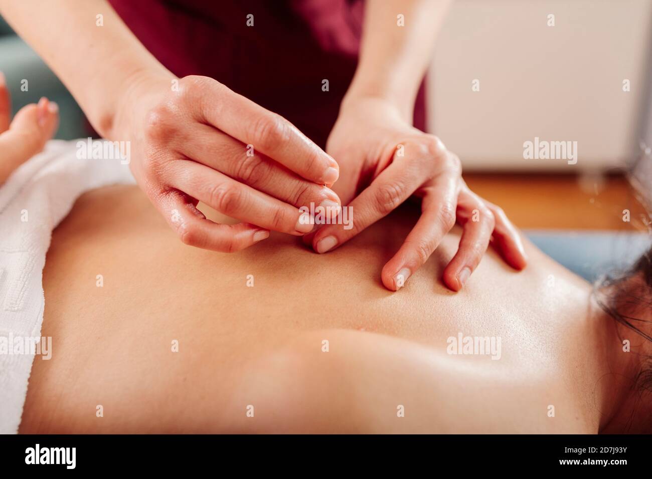 Physiothérapeute tenant l'aiguille sur le dos de la femme Banque D'Images