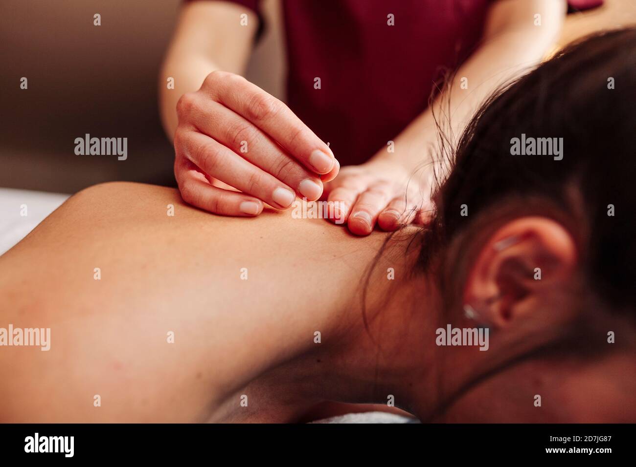 Un physiothérapeute insère l'aiguille dans le dos tout en appliquant un traitement d'aiguille sèche Banque D'Images