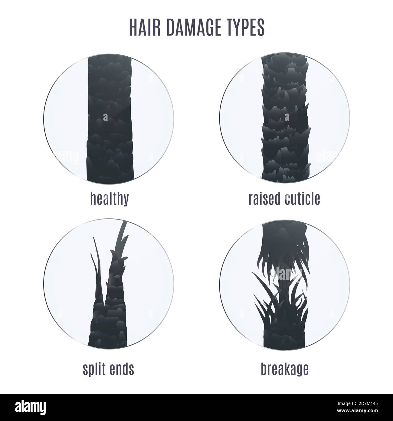 Surface de cheveux sains et abîmés sous le microscope, illustration. Extrémités fendues, rupture et cuticule en relief. Banque D'Images