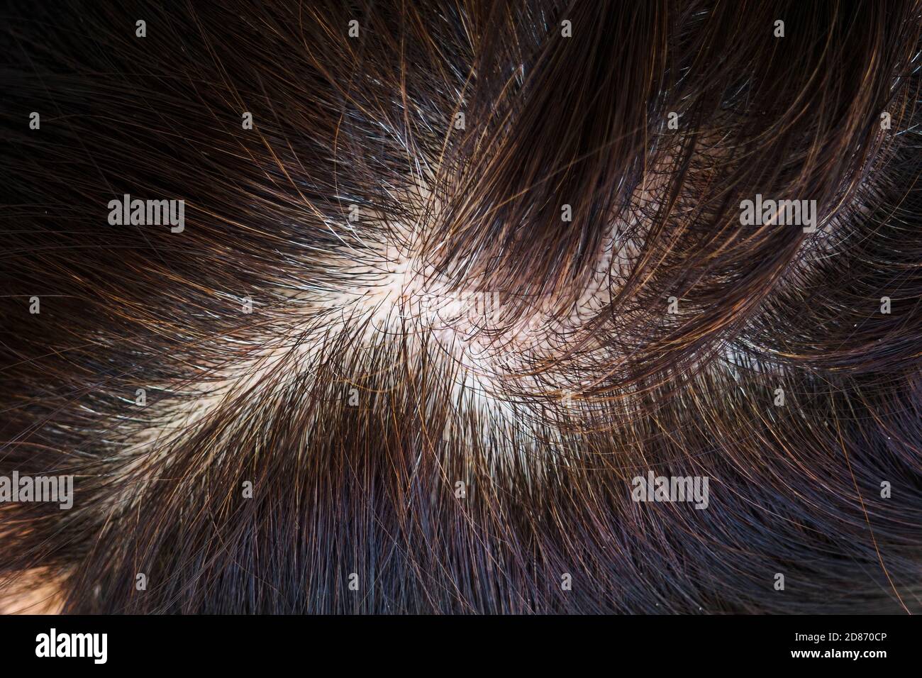 Tête pour femme avec cheveux gris, vue rapprochée des racines recrées, vue de dessus, mise au point sélective. Banque D'Images