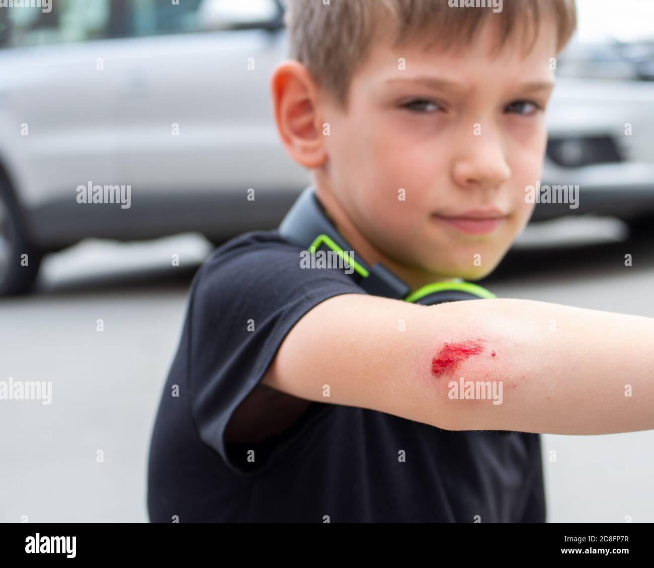 Foyer sélectif garçon avec une plaie fraîche sur son bras, coude avec du sang. L'homme s'est blessé la main après sa chute. Copier l'espace Banque D'Images