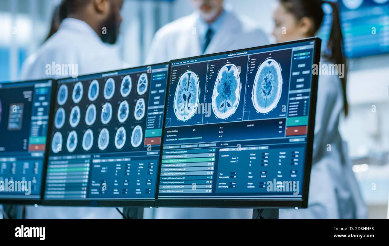 Écran de l'ordinateur montrant l'IRM, l'acquisition d'images CT du cerveau. Lors de la réunion de fond de l'équipe de médecins scientifiques du laboratoire de recherche sur le cerveau Banque D'Images